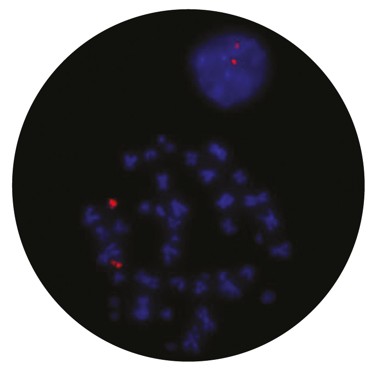 Fluorescence in situ hybridization (FISH) microscope image of the CytoCell MAFB Plus probe.