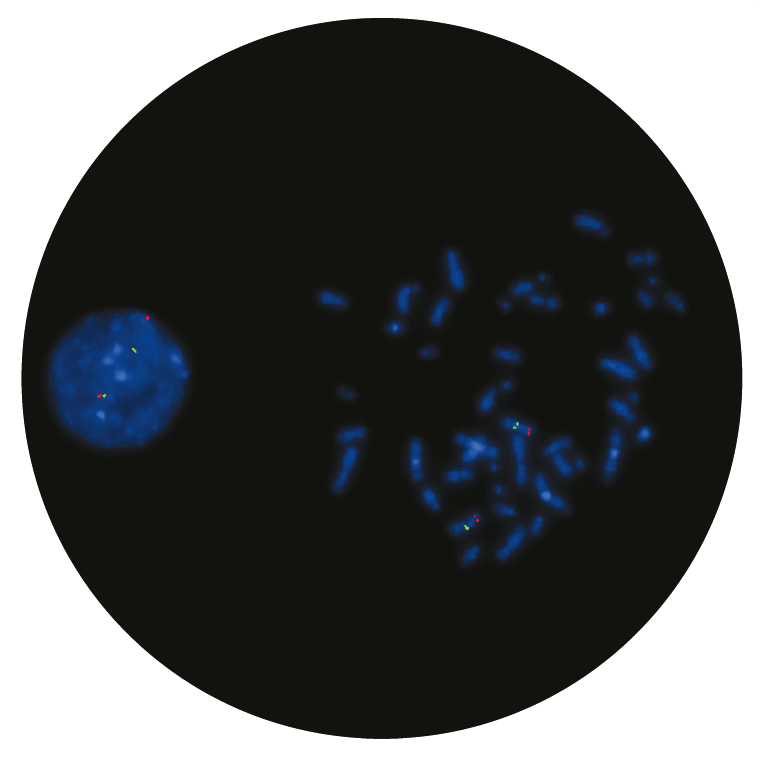 Fluorescence in situ hybridization (FISH) microscope image of the CytoCell Saethre-Chotzen Region/Williams-Beuren probe.
