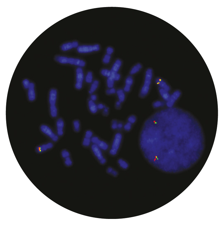 Fluorescence in situ hybridization (FISH) microscope image of the CytoCell TLX1 Breakapart probe.