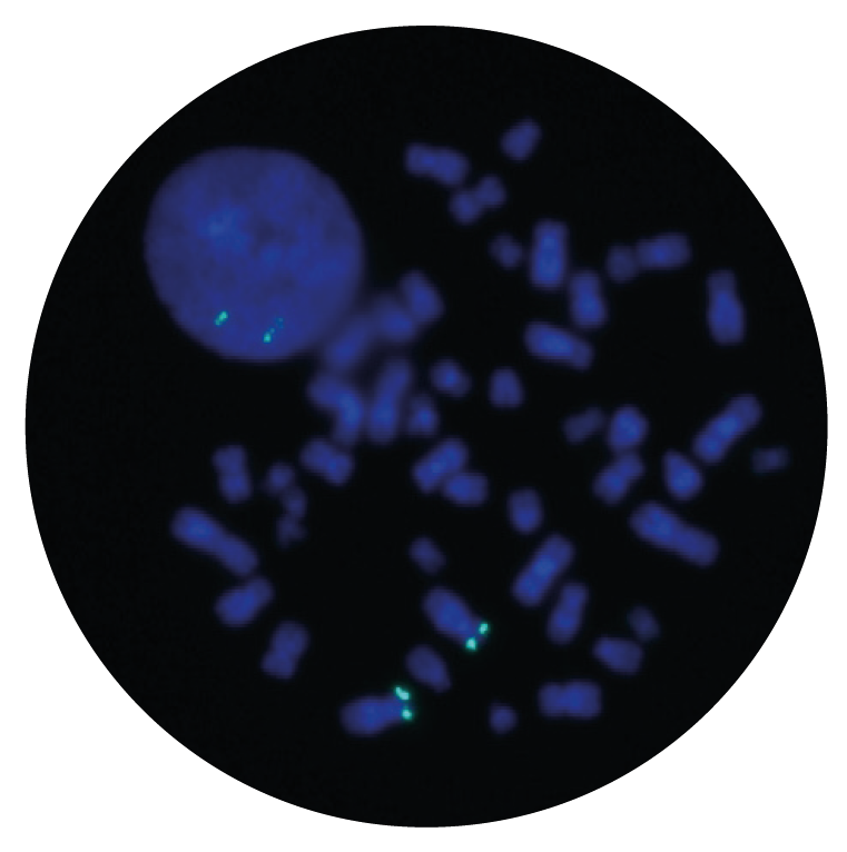 Fluorescence in situ hybridization (FISH) microscope image of the CytoCell TERT (5p15.33) Probe Aqua.