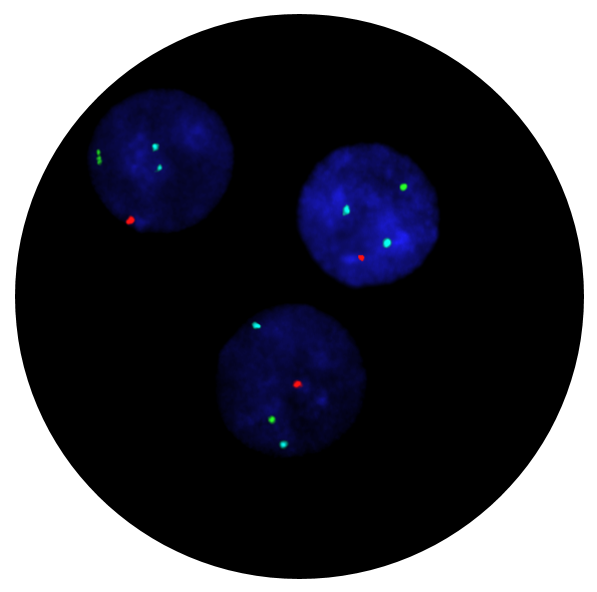Fluorescence in situ hybridisation (FISH) microscope image of the CytoCell FAST FISH Prenatal X, Y, 13, 18 and 21 probe.
