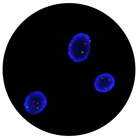 Fluorescence in situ hybridisation (FISH) microscope image of the CytoCell FAST FISH Prenatal 13 and 21 probe.