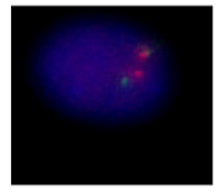 IGH Plus Breakapart (LPH 070) using 5ul probe + 5ul Cytocell Hybridisation A (HA500L)