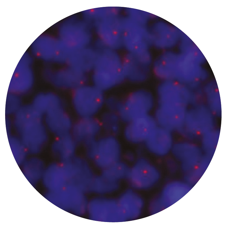 Fluorescence in situ hybridization (FISH) microscope image of the CytoCell TFE3 Proximal Probe Red.