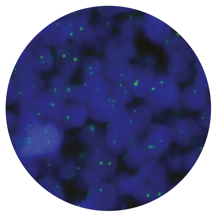Fluorescence in situ hybridization (FISH) microscope image of the CytoCell FUS Distal Probe Green.
