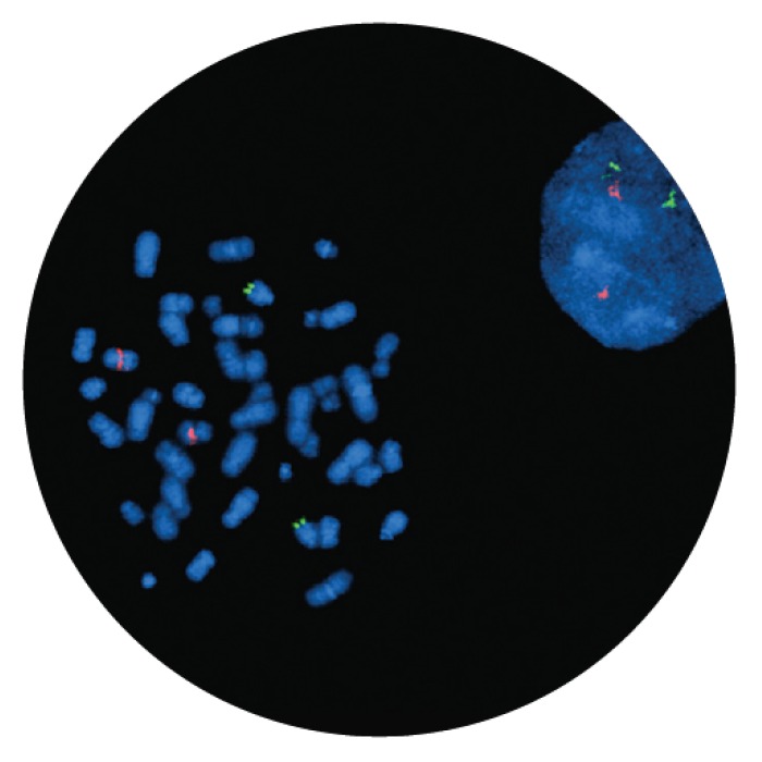 Fluorescence in situ hybridization (FISH) microscope image of the CytoCell IGH/CCND1 Translocation, Dual Fusion probe.