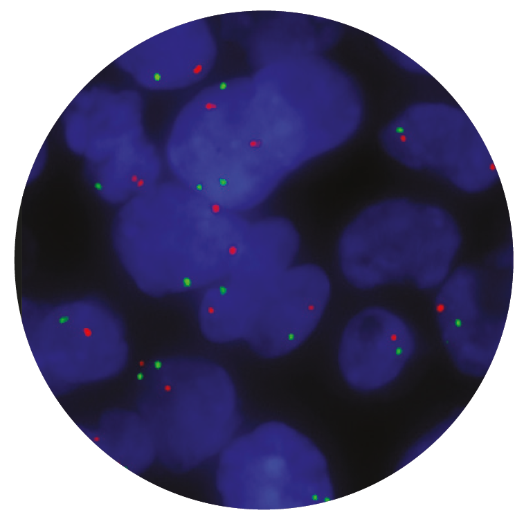 Fluorescence in situ hybridization (FISH) microscope image of the CytoCell N-MYC (MYCN) Amplification probe.