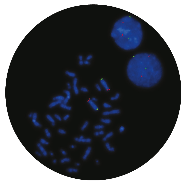 Fluorescence in situ hybridisation (FISH) microscope image of the CytoCell Wolf-Hirschhorn (WHSCR) probe.