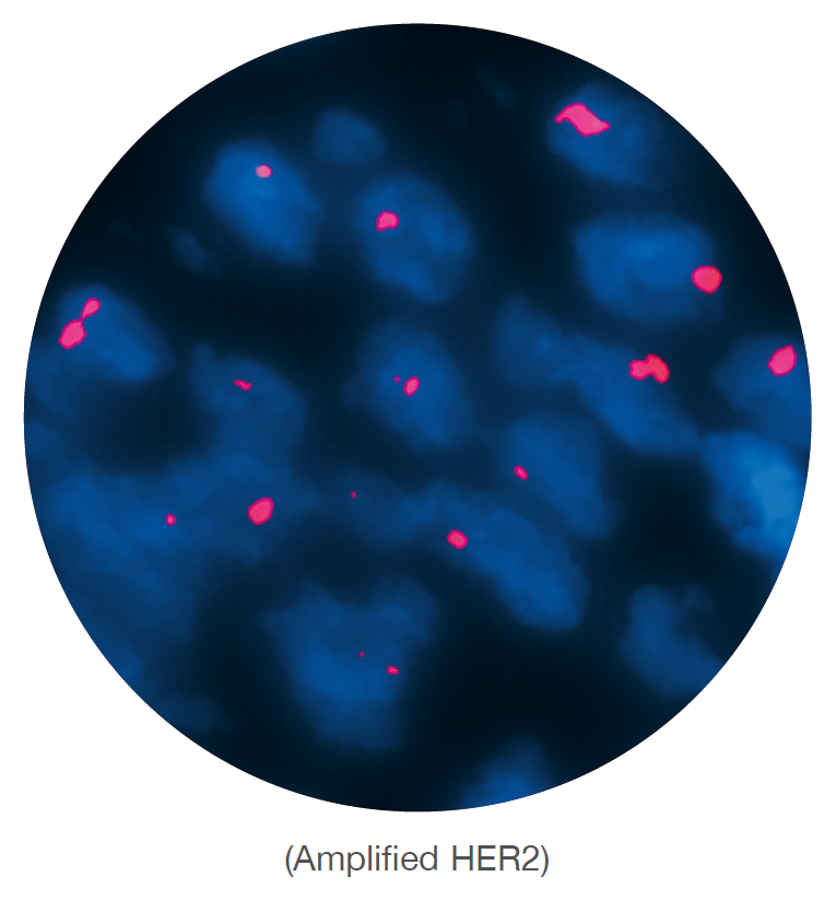 Fluorescence in situ hybridization (FISH) microscope image of the CytoCell HER2 (ERBB2) Amplification probe.