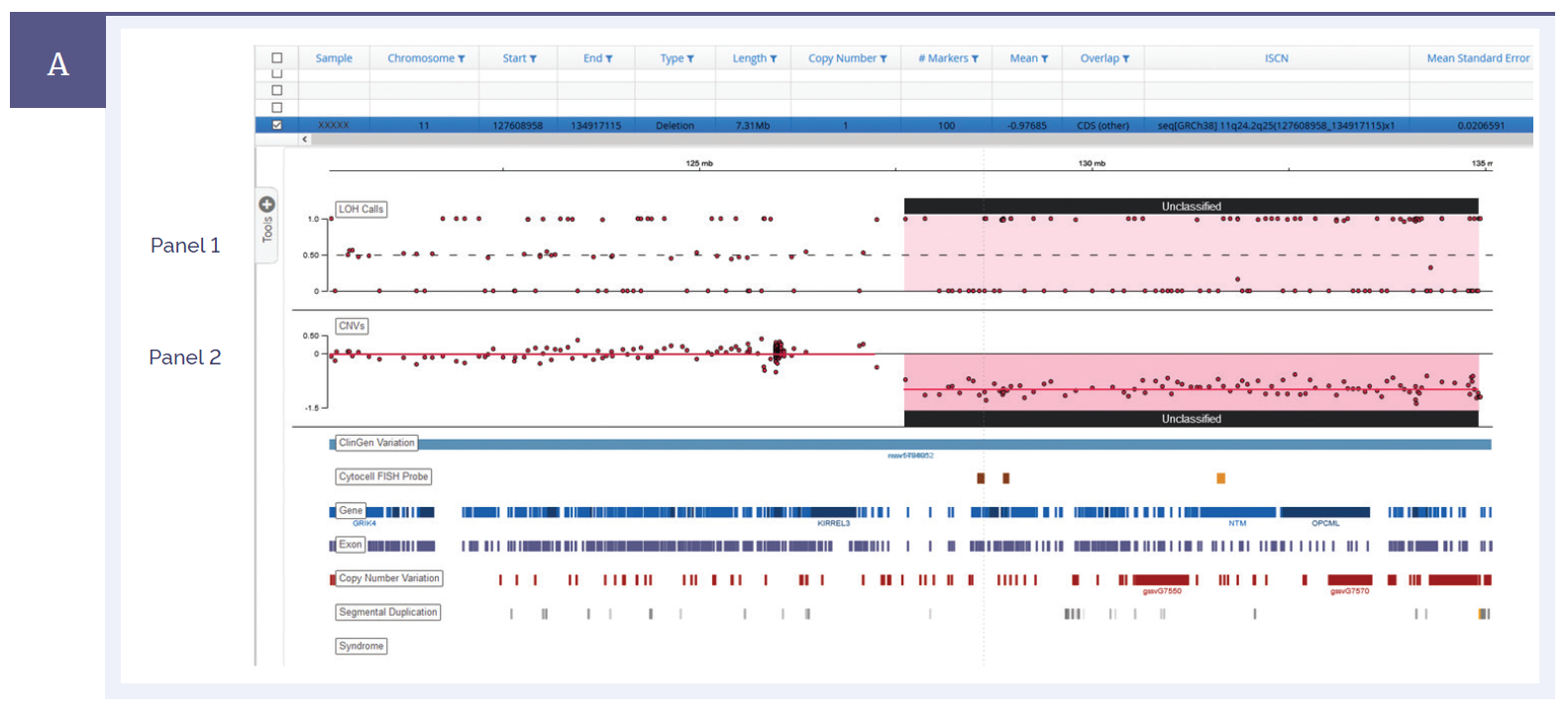 Next generation sequencing (NGS) software data showing a 7.3Mb deletion detected on chromosome 11.
