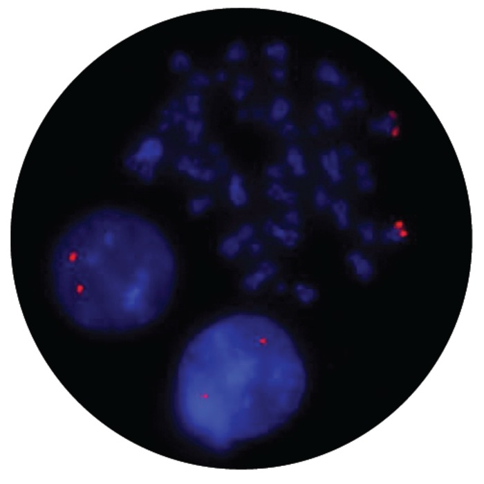 Fluorescence in situ hybridization (FISH) microscope image of the CytoCell cMYC (MYC) Plus probe.