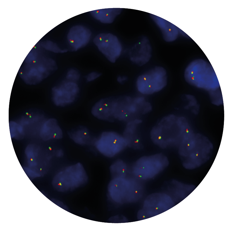 Fluorescence in situ hybridisation (FISH) microscope image of the CytoCell IGL Breakapart probe.