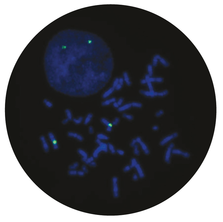 Fluorescence in situ hybridization (FISH) microscope image of the CytoCell Centromere 7 Probe Green.