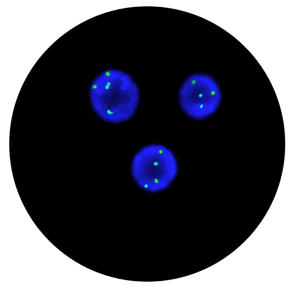 Fluorescence in situ hybridisation (FISH) microscope image of the CytoCell FAST FISH Prenatal X, Y, 13, 18 and 21 probe.