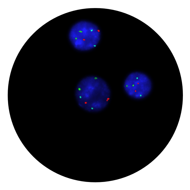 Fluorescence in situ hybridisation (FISH) microscope image of the CytoCell Prenatal 13, 18 and 21 probe.