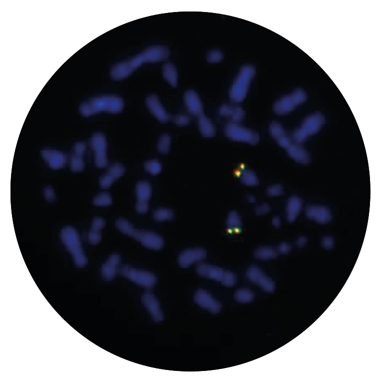 Fluorescence in situ hybridisation (FISH) microscope image of the CytoCell IGH Plus Breakapart probe.