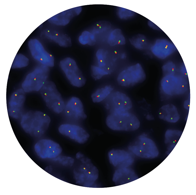 Fluorescence in situ hybridisation (FISH) microscope image of the CytoCell ROS1 Breakapart probe.