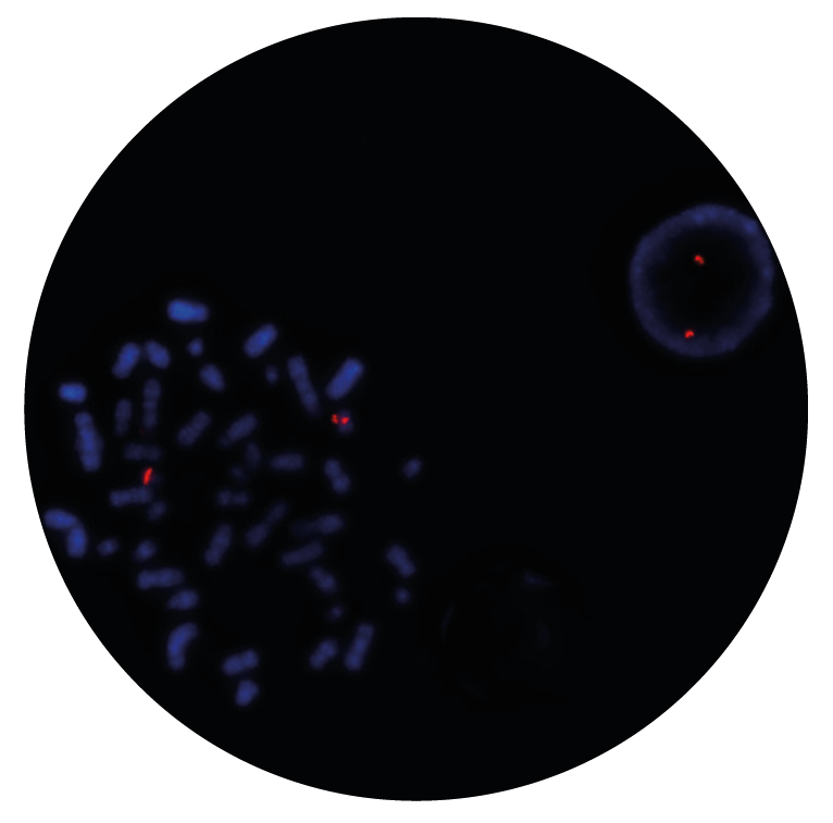 Fluorescence in situ hybridization (FISH) microscope image of the CytoCell RARα (RARA) Proximal probe.