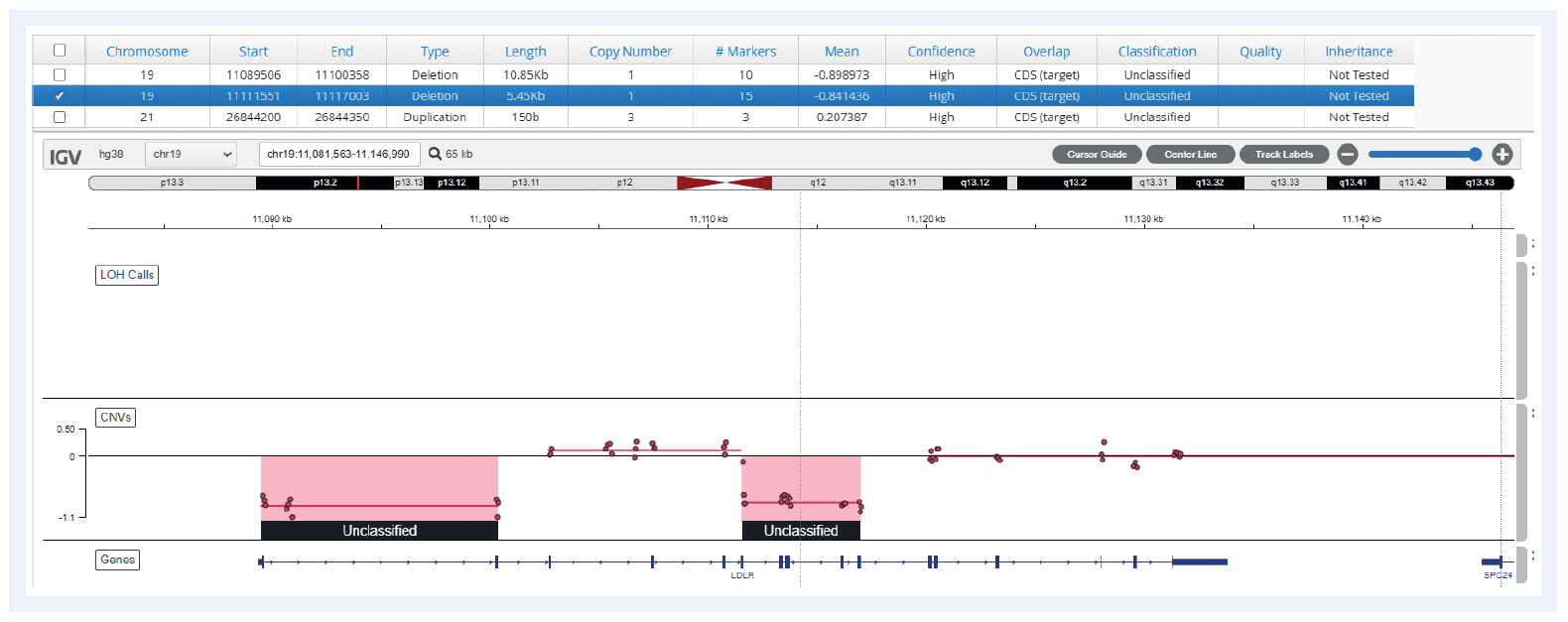 Next generation sequencing (NGS) software data showing a double deletion on the LDR gene.