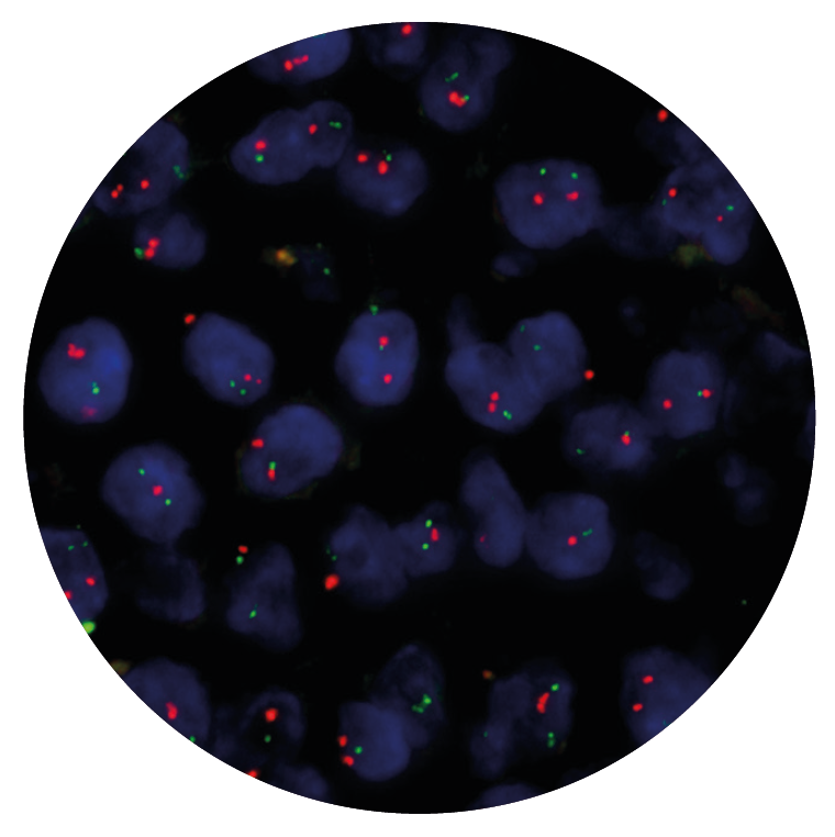 Fluorescence in situ hybridisation (FISH) microscope image of the CytoCell IGH/CCND1 Translocation, Dual Fusion probe.