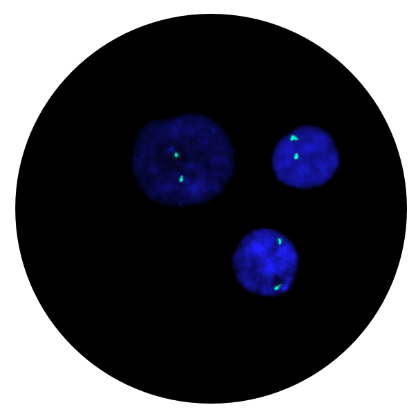 Fluorescence in situ hybridisation (FISH) microscope image of the CytoCell Prenatal 18 Centromere probe.