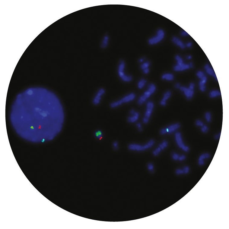 Fluorescence in situ hybridization (FISH) microscope image of the CytoCell SRY probe.