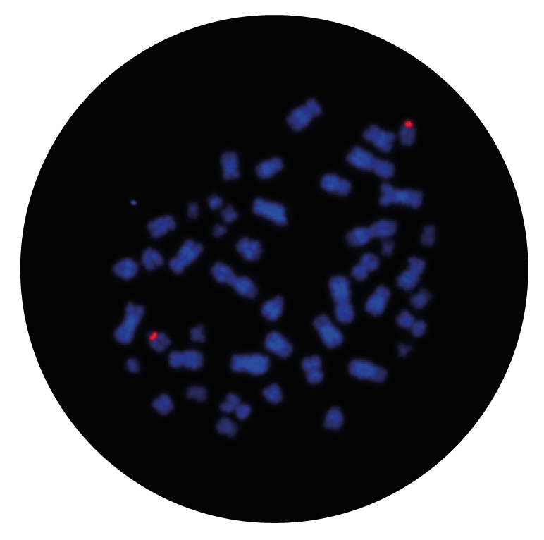 Fluorescence in situ hybridization (FISH) microscope image of the CytoCell Chromosome 15 Alpha Satellite Probe Red.