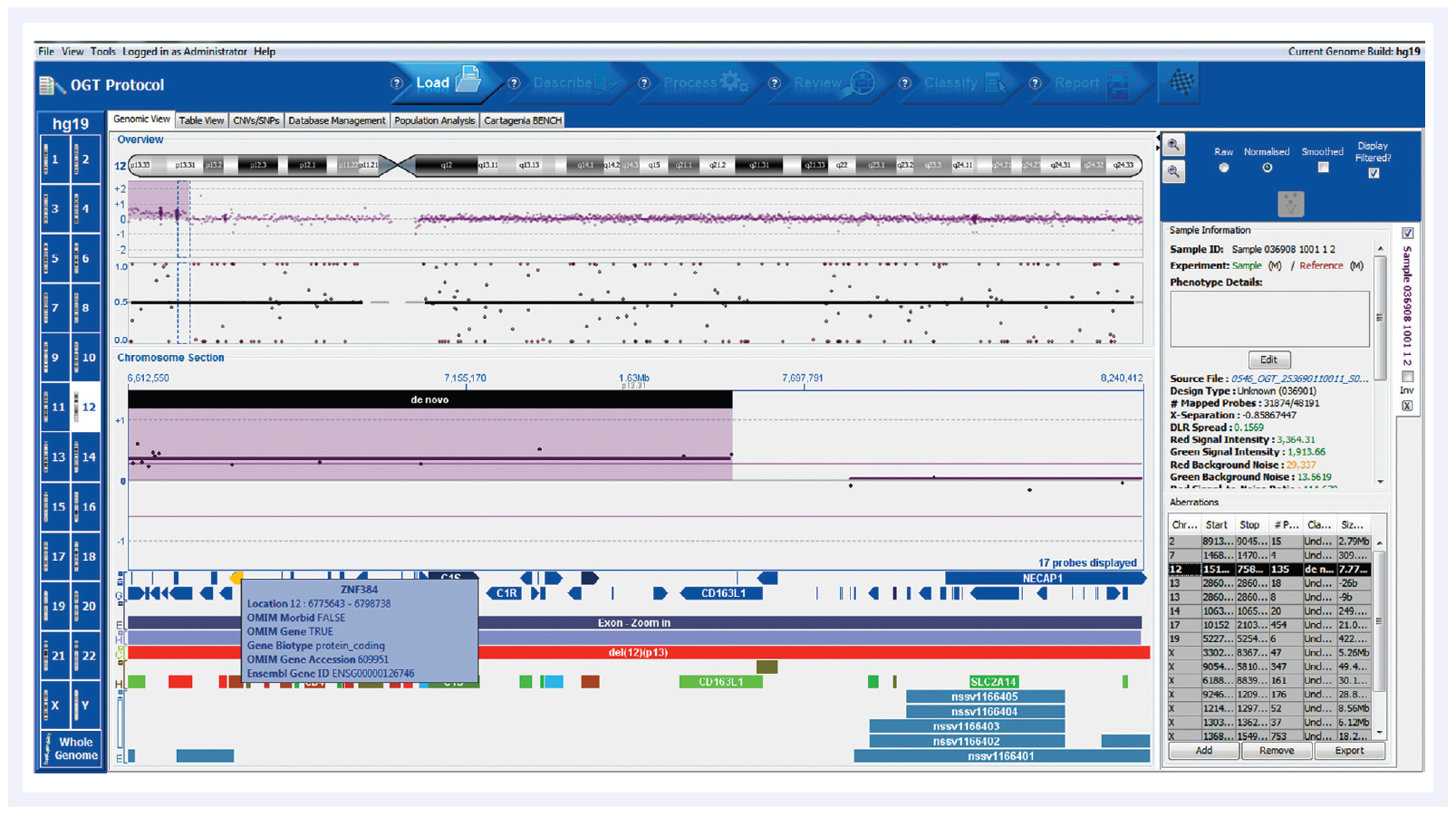 aCGH software data showing a gain on chromosome 12 for a chronic lymphocytic leukaemia (CLL) sample.