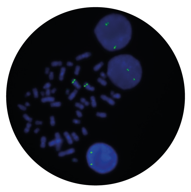 Fluorescence in situ hybridization (FISH) microscope image of the CytoCell EGR1/CDC25C (5q31) Probe Green.