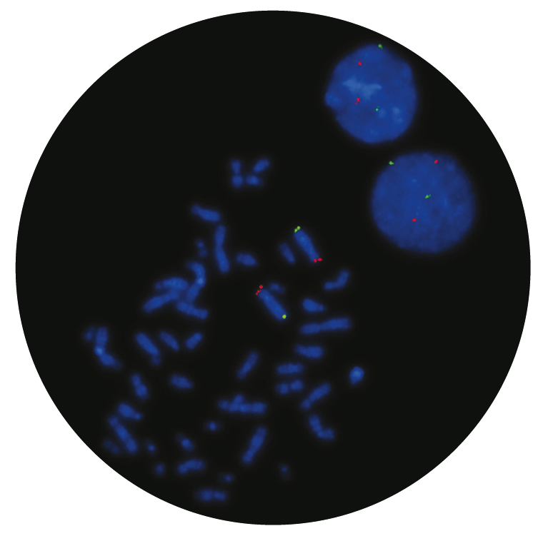 Fluorescence in situ hybridization (FISH) microscope image of the CytoCell Wolf-Hirschhorn Region probe.