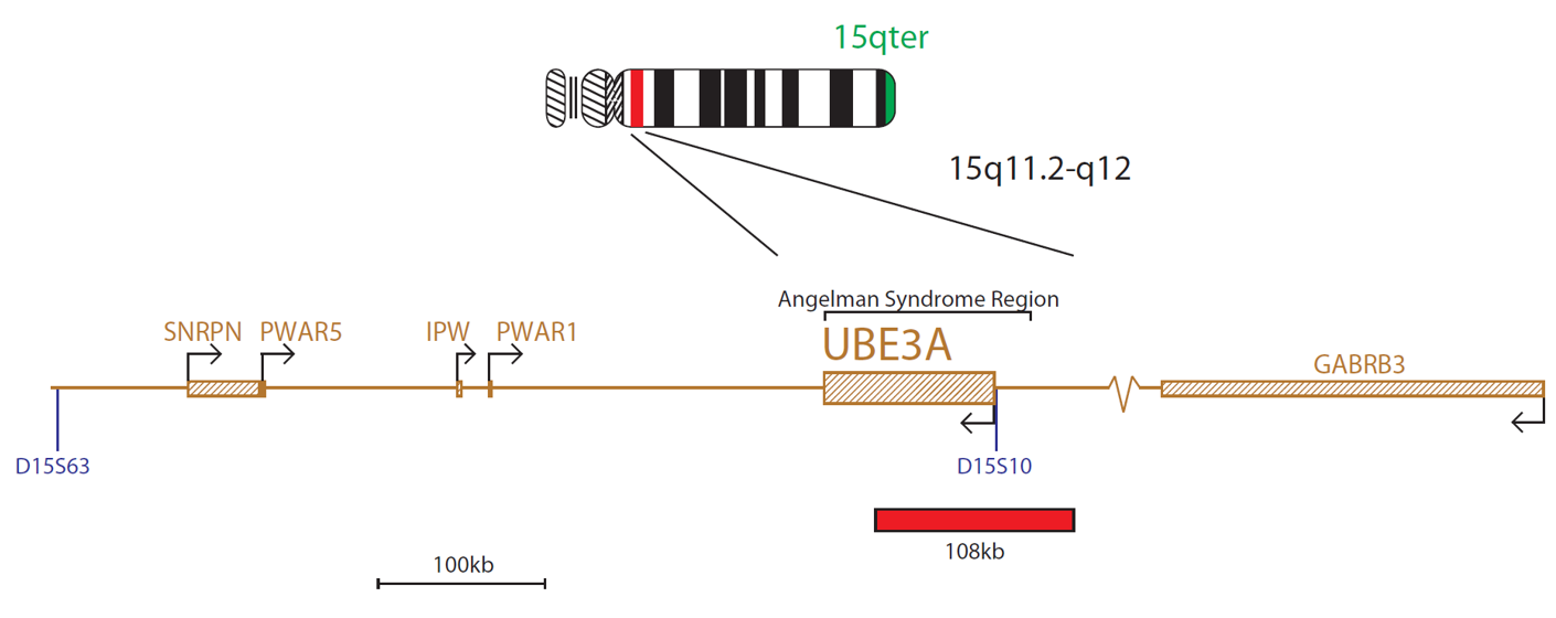 FISH chromosome map showing a probe targeting a region associated with Angelman syndrome (UBE3A gene).