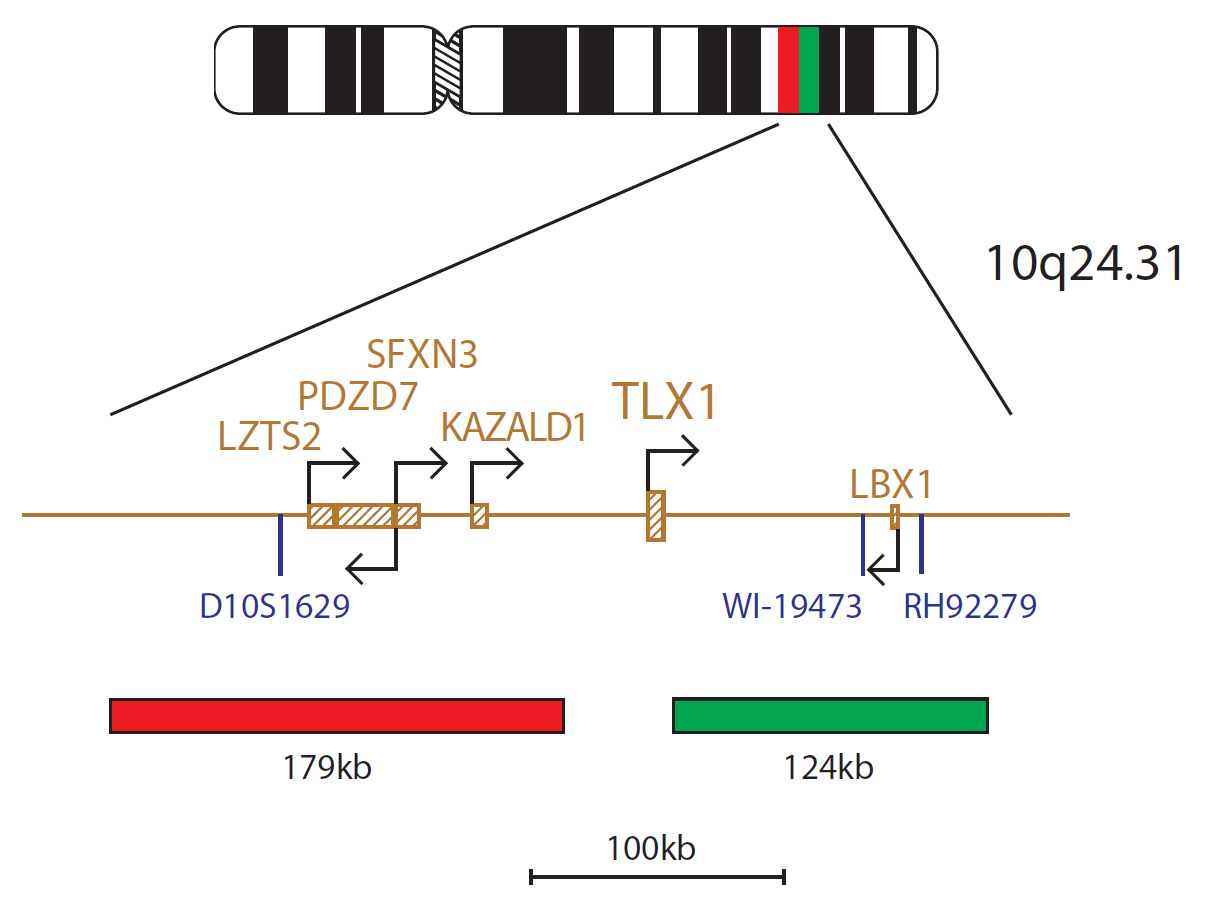 Fluorescence in situ hybridization (FISH) chromosome map showing a probe targeting the TLX1 gene.