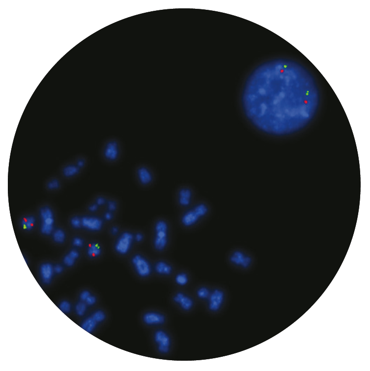 Fluorescence in situ hybridisation (FISH) microscope image of the CytoCell 13q14.3 Deletion probe.