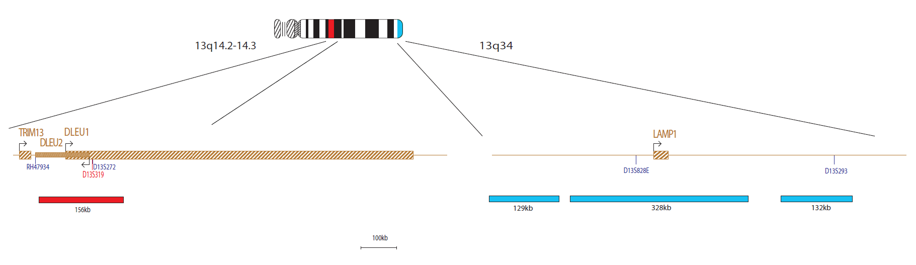 Fluorescence in situ hybridisation (FISH) chromosome map showing a probe targeting the regions 13q14.2 and 13q34.