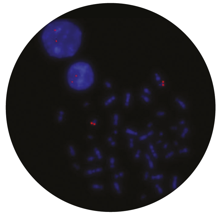 Fluorescence in situ hybridization (FISH) microscope image of the CytoCell BCL2 Plus probe.