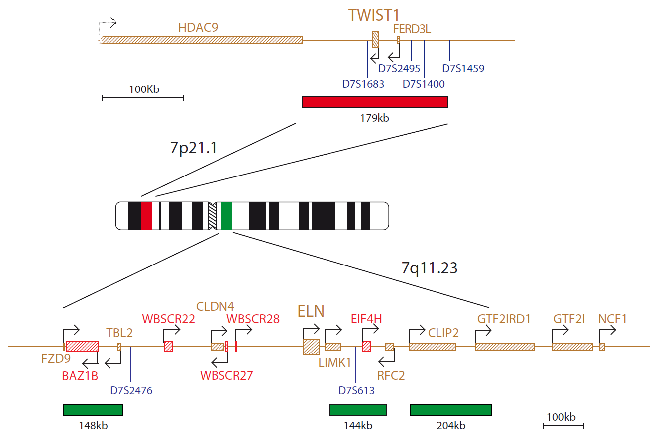 FISH chromosome map showing a probe targeting regions associated with Saethre-Chotzen and Williams-Beuren syndromes.
