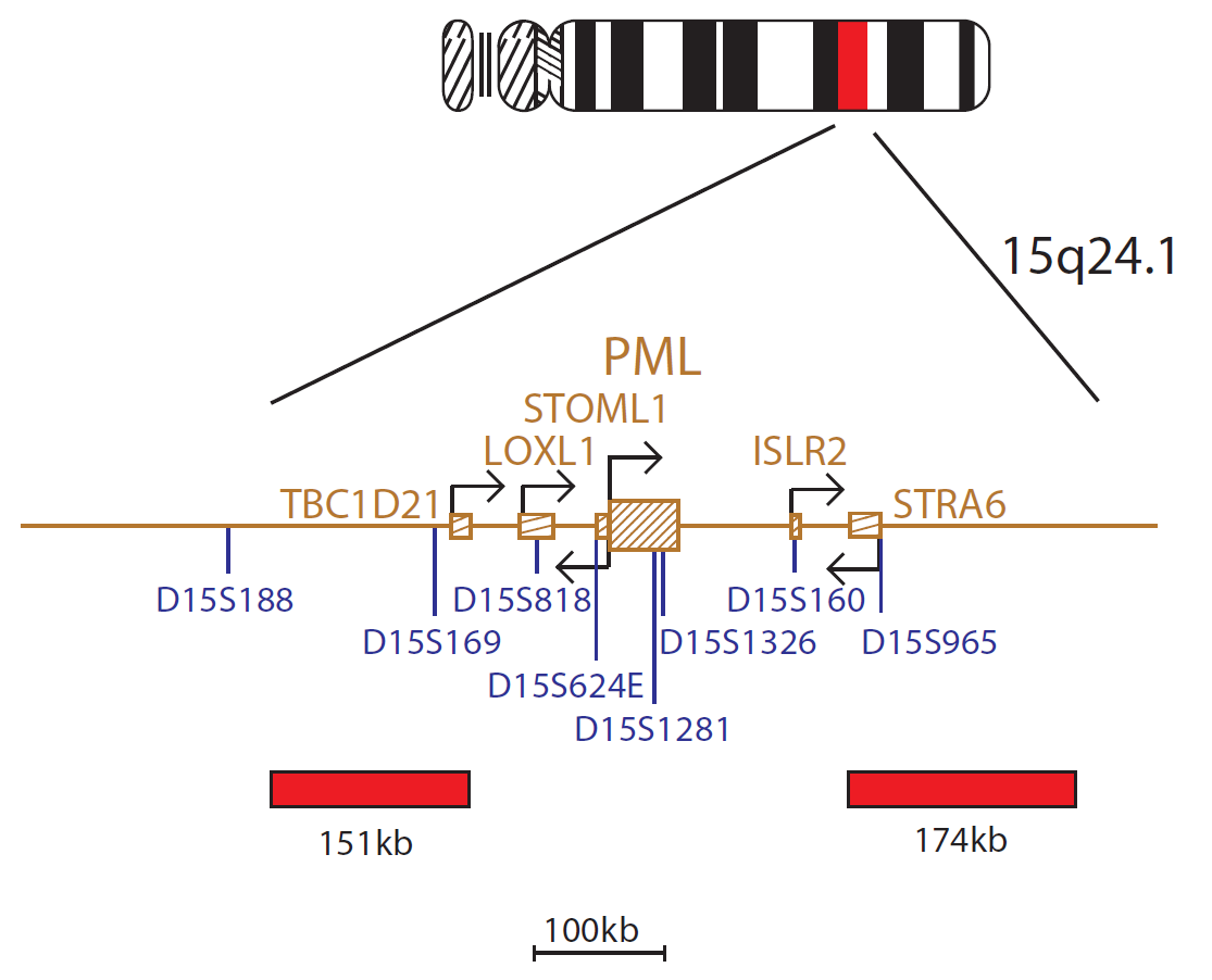 Fluorescence in situ hybridization (FISH) chromosome map showing a probe targeting the PML gene.