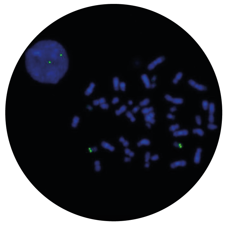 Fluorescence in situ hybridization (FISH) microscope image of the CytoCell P53 (TP53) Probe Green.