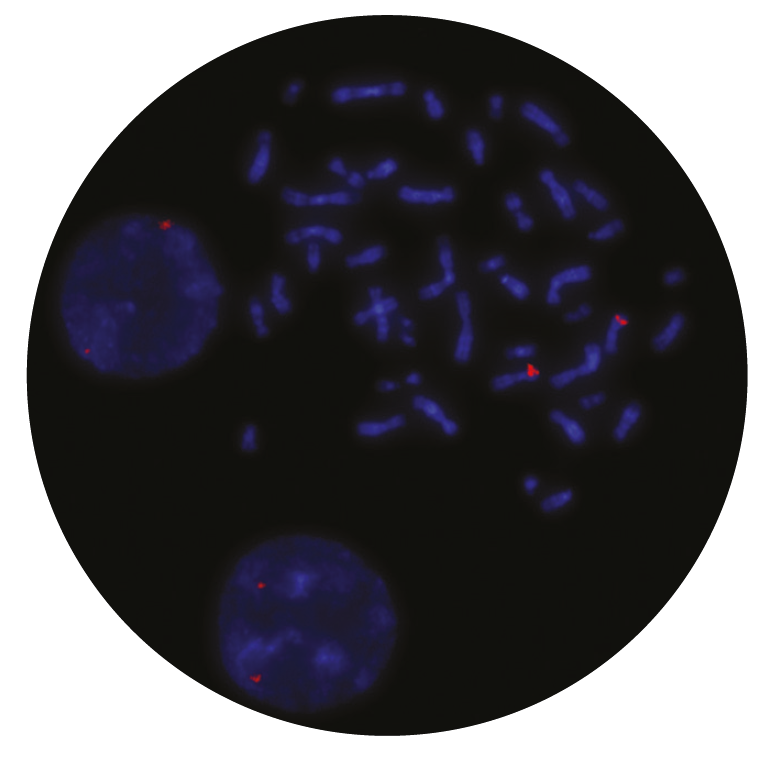 Fluorescence in situ hybridization (FISH) microscope image of the CytoCell MLLT3 probe.