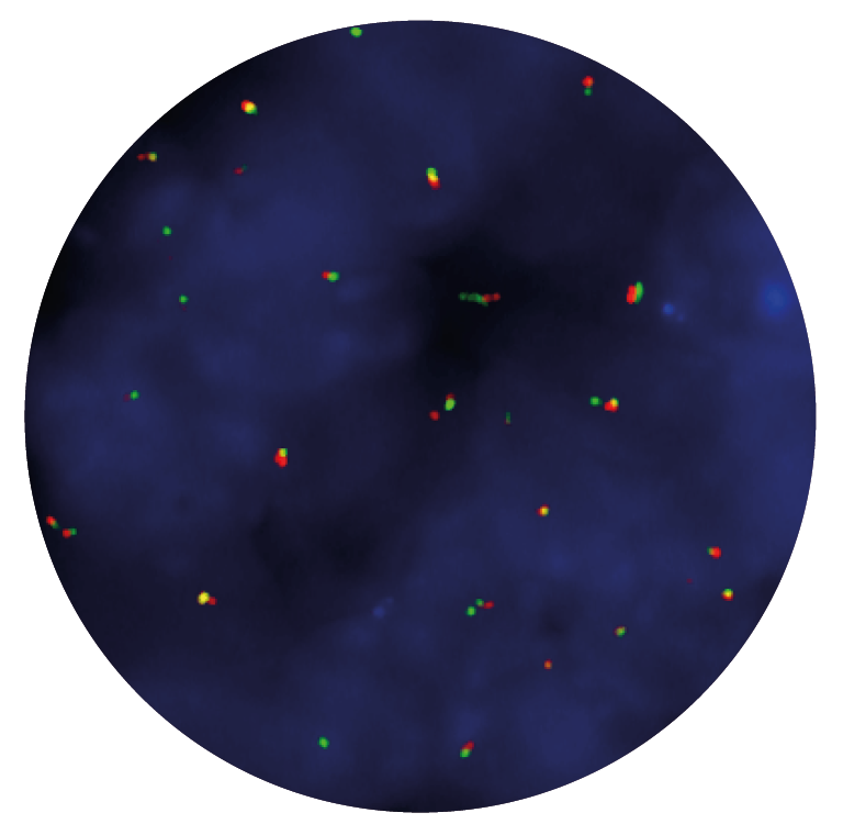 Fluorescence in situ hybridisation (FISH) microscope image of the CytoCell CCND1 Breakapart probe.