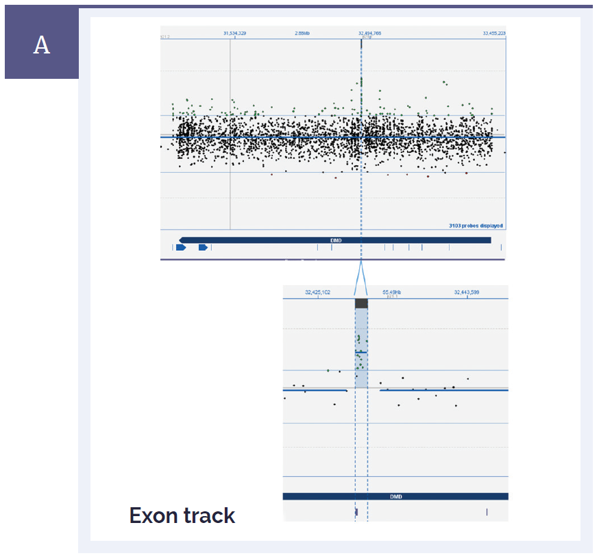 aCGH software data showing a complete view of the DMD gene and a close-up view showing a small duplication of 1.4kb.