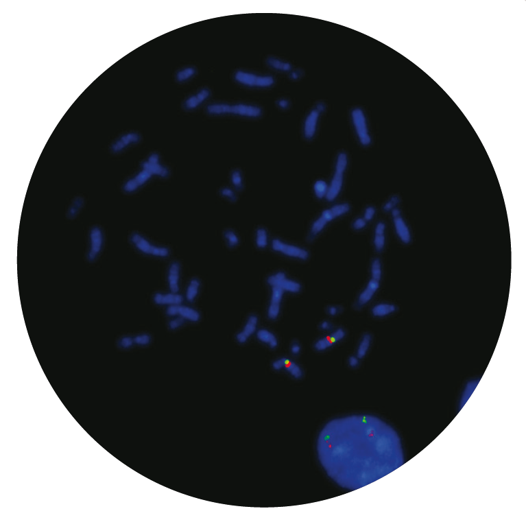 Fluorescence in situ hybridization (FISH) microscope image of the CytoCell Williams-Beuren Region probe.