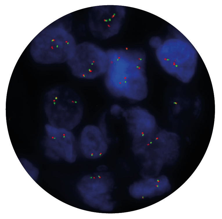 Fluorescence in situ hybridisation (FISH) microscope image of the CytoCell BCL6 Breakapart probe.