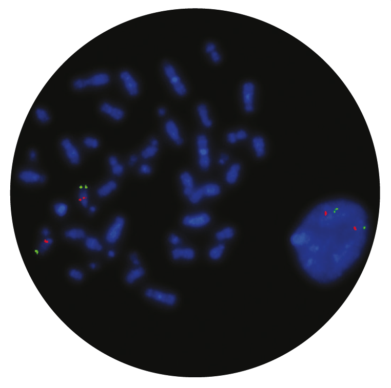 Fluorescence in situ hybridization (FISH) microscope image of the CytoCell Smith-Magenis (RAI1)/Miller-Dieker Region probe.