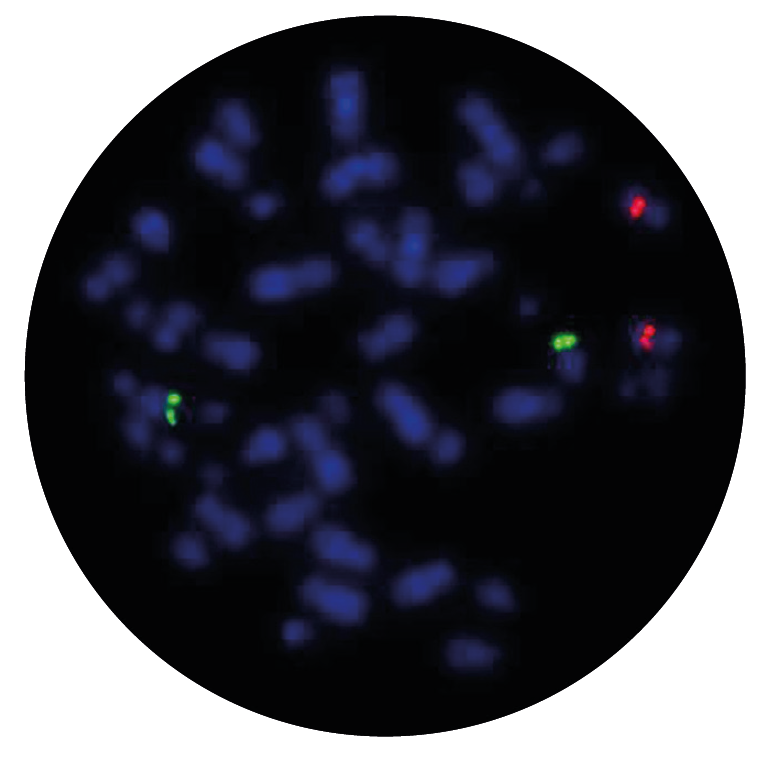 Fluorescence in situ hybridisation (FISH) microscope image of the CytoCell IGH/CCND1 Plus Translocation, Dual Fusion probe.