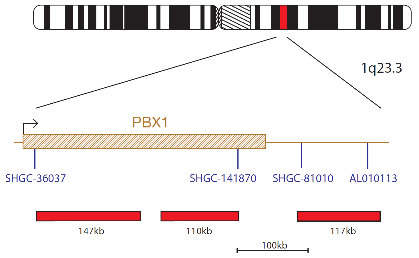 Fluorescence in situ hybridization (FISH) chromosome map showing a probe targeting the PBX1 gene.