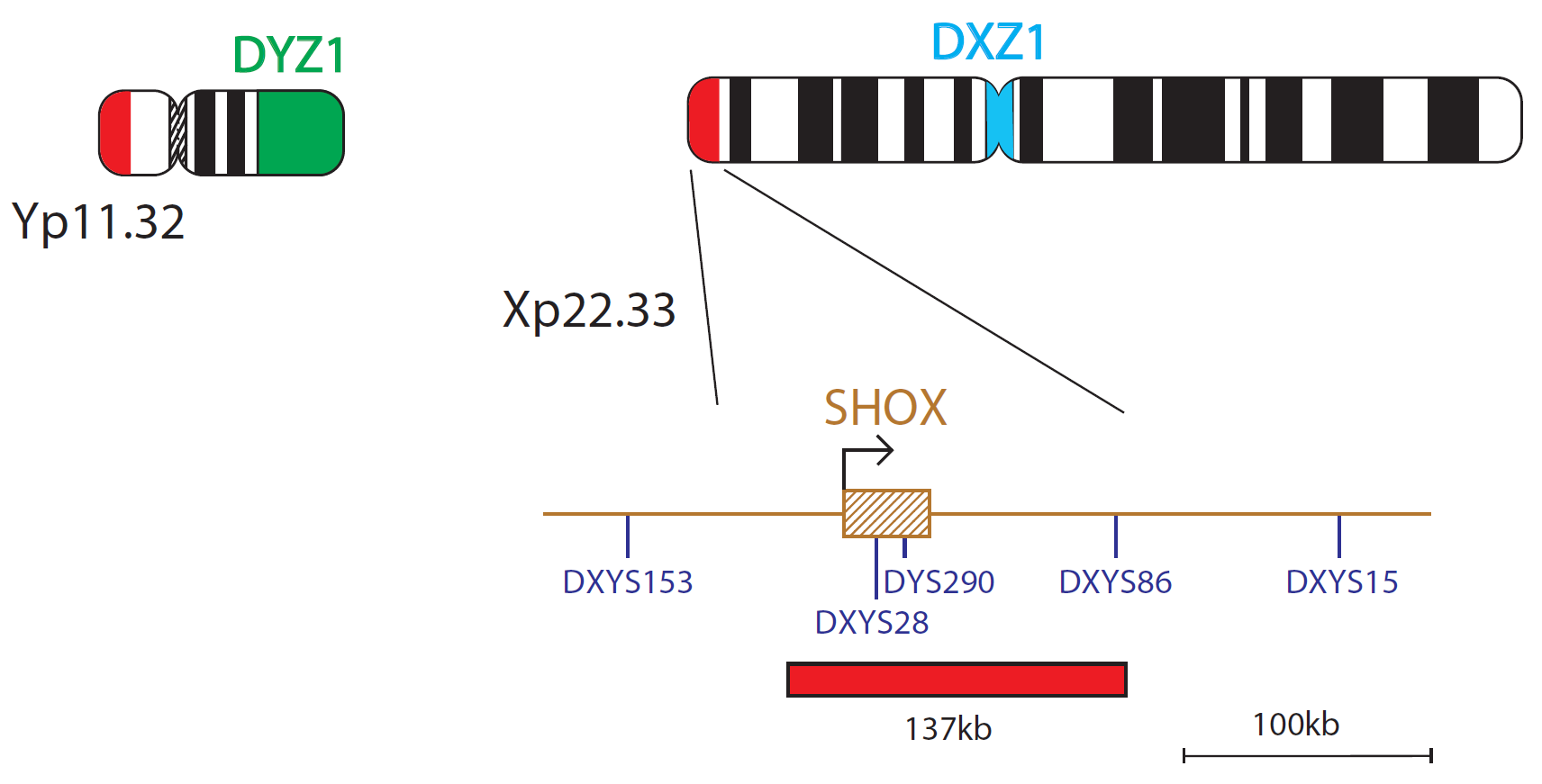 Fluorescence in situ hybridisation (FISH) chromosome map showing a probe targeting the SHOX gene.