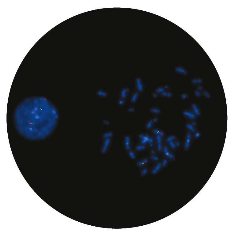 Fluorescence in situ hybridisation (FISH) microscope image of the CytoCell Saethre-Chotzen/Williams-Beuren probe.