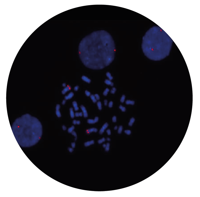 Fluorescence in situ hybridization (FISH) microscope image of the CytoCell MECOM Probe Red.