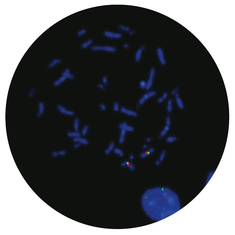 Fluorescence in situ hybridisation (FISH) microscope image of the CytoCell Williams-Beuren probe.